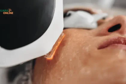 Treatment IPL, Perawatan Kulit Populer Rahasia Kulit Mulus dan Awet Muda