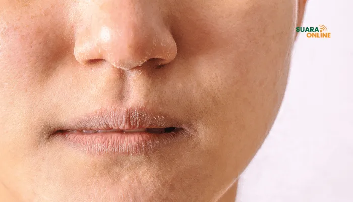 5 Penyebab Bibir Kering dan Cara Mengatasinya Secara Alami