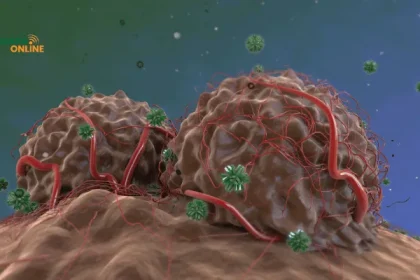 Perbedaan Tumor Jinak dan Tumor Ganas, Apakah Semua Tumor Berbahaya?