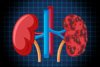 Waspada! Lonjakan Kasus Gagal Ginjal pada Anak dan Kelalaian Orang Dewasa di Baliknya
