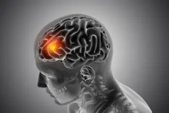 male medical figure with front brain highlighted